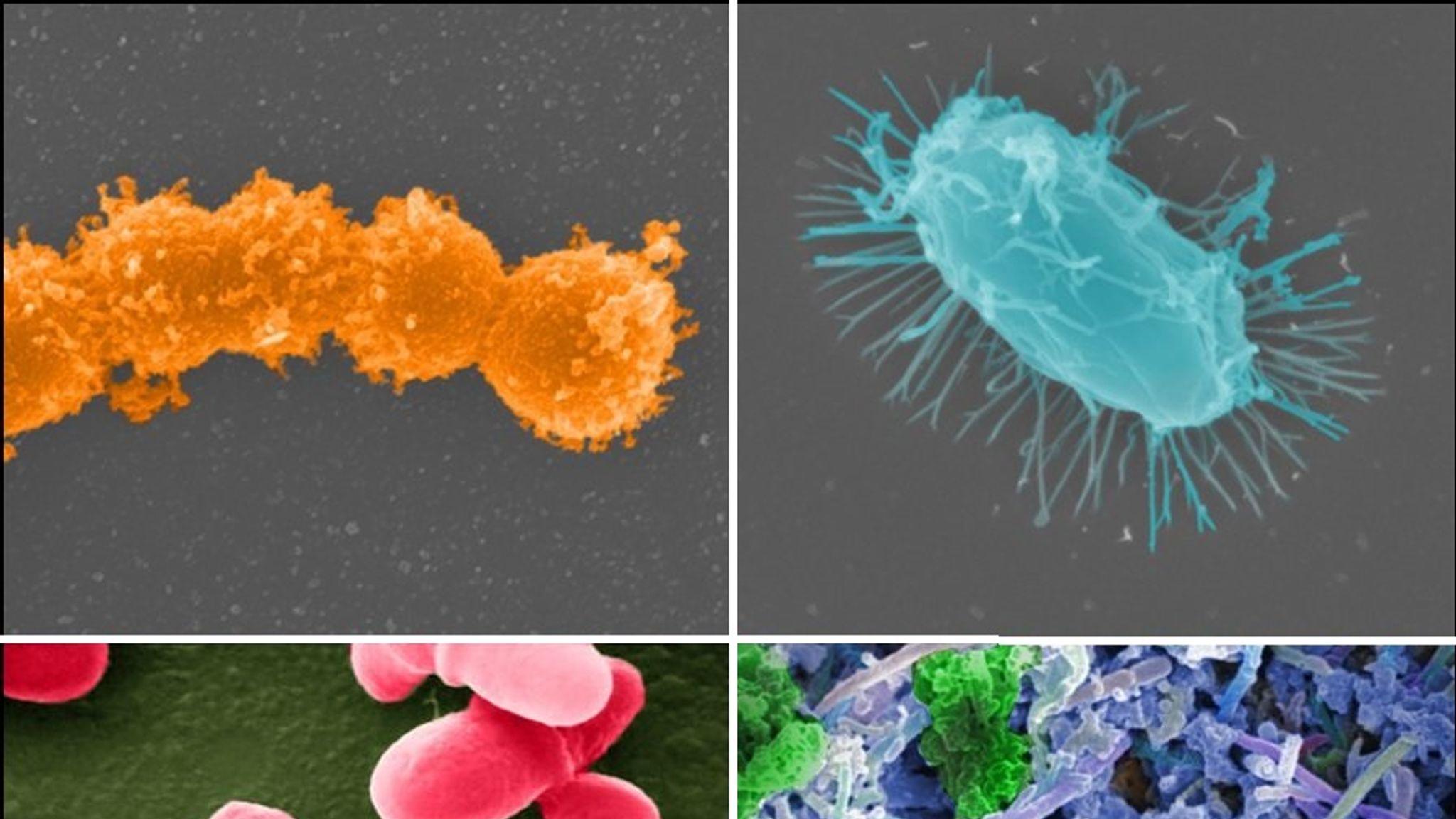 чем лечить микроб