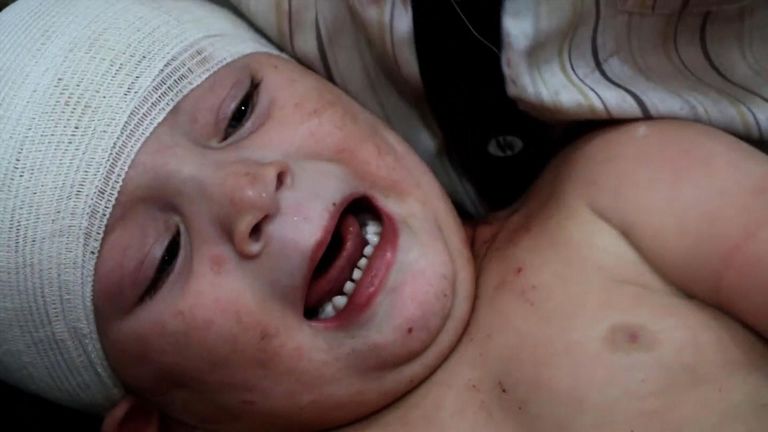 A child who is among the thousands affected by bombing in Aleppo