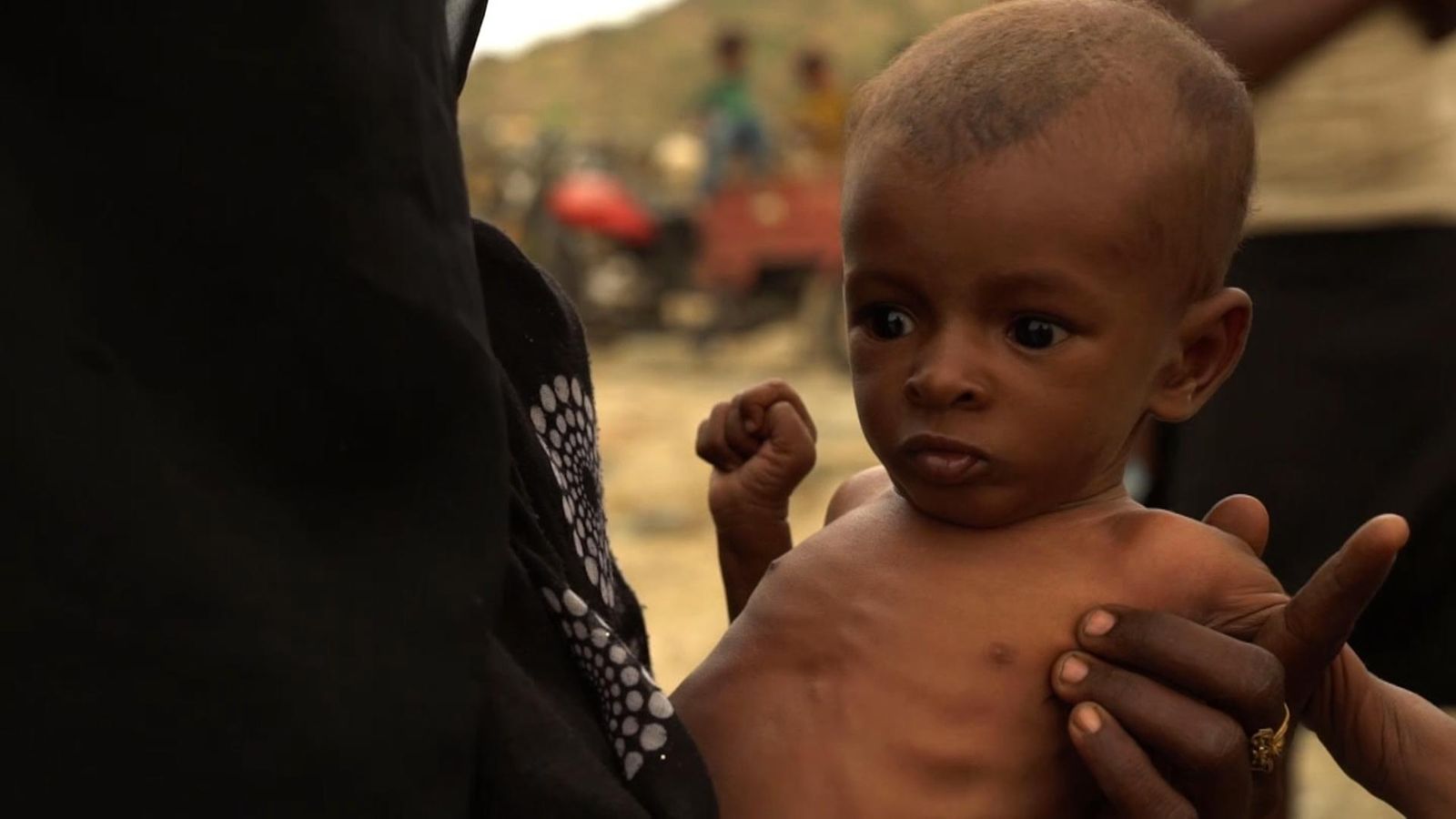 400,000 young lives at risk in Yemen | World News | Sky News