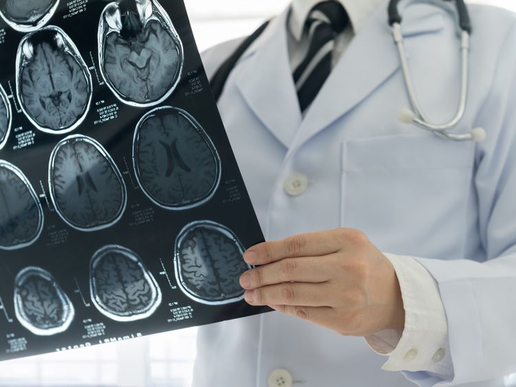 Therapy for 'mad cow-like' brain disease approved Therapy for 'mad cow-like' brain disease approved