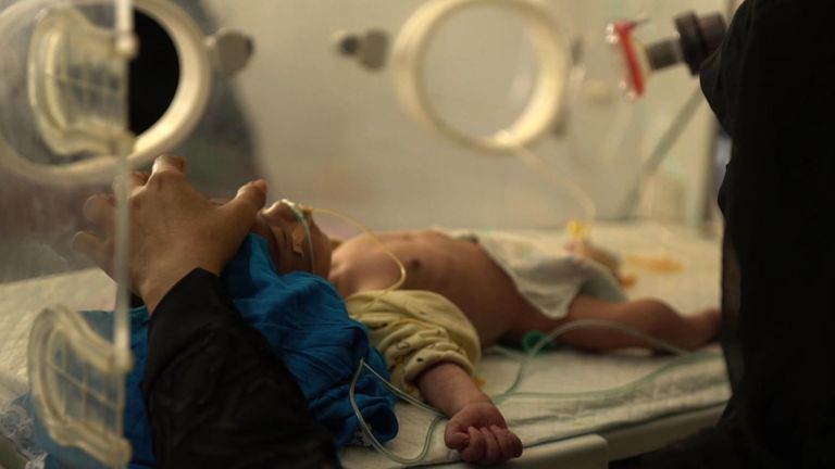 Countless children are dying from lack of food and healthcare in Yemen