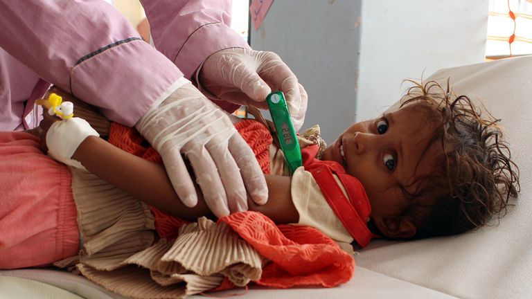 A Yemeni child suspected of being infected with cholera is checked in the northern district of Abs last year