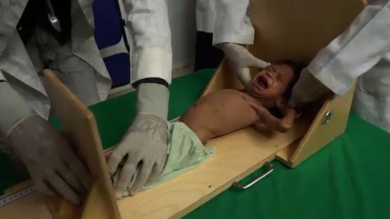 A Yemeni baby cries in hospital