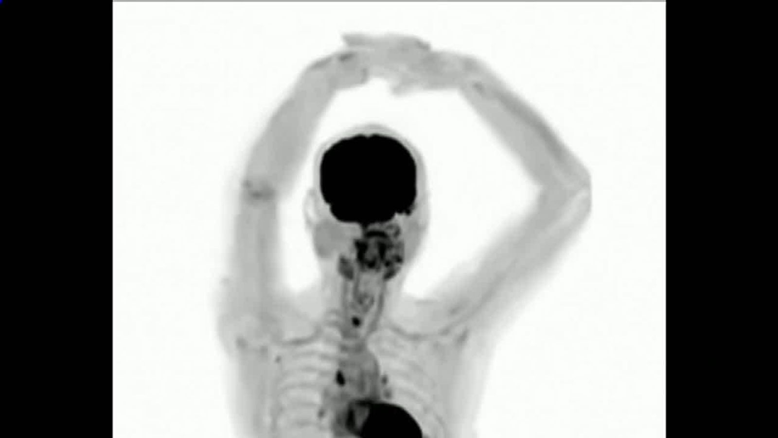 human-images-from-world-s-first-full-body-3d-scanner-science-tech