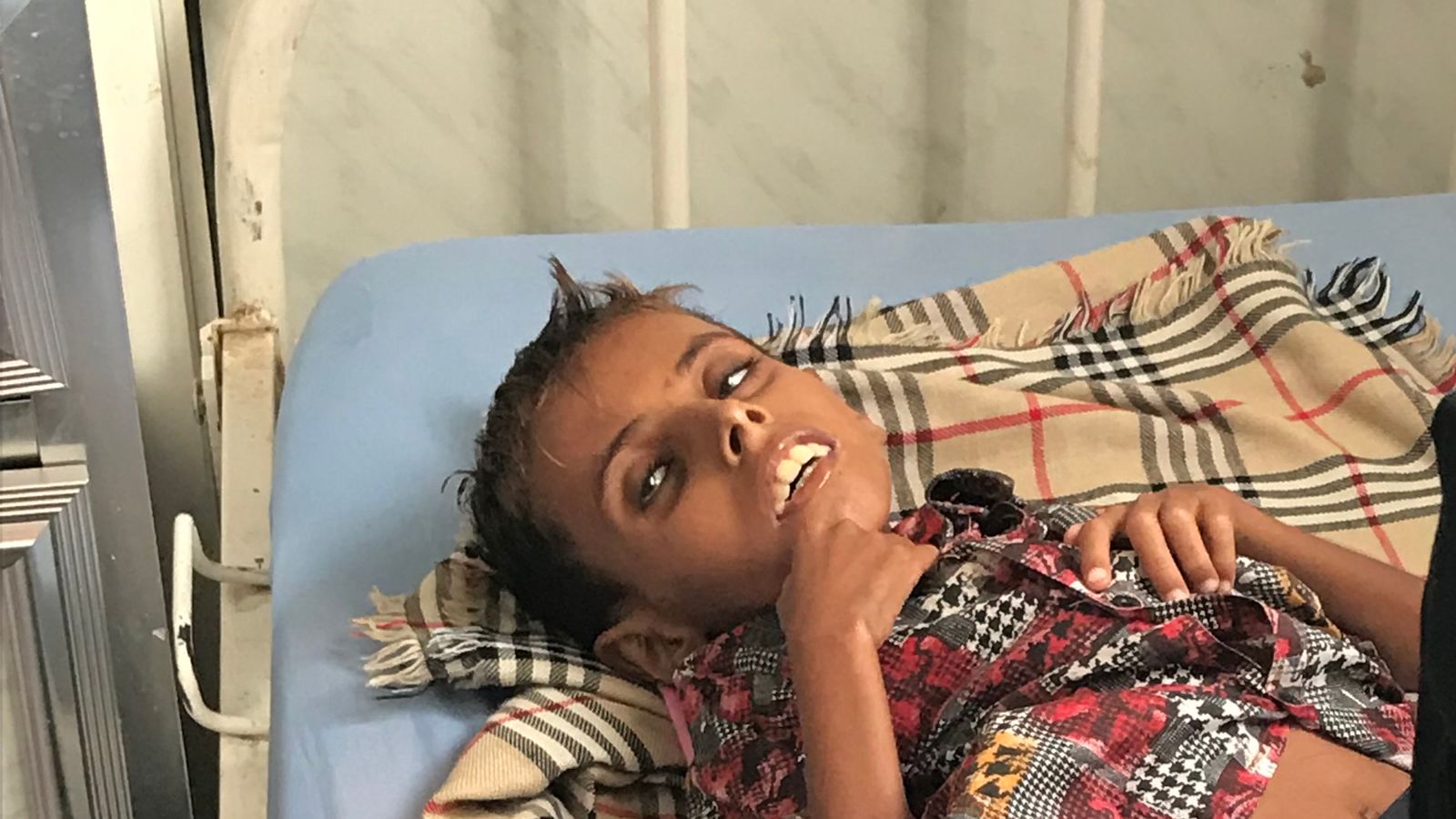 Yemen: The 10-year-old boy who weighs just 22lbs in a country on the brink of famine