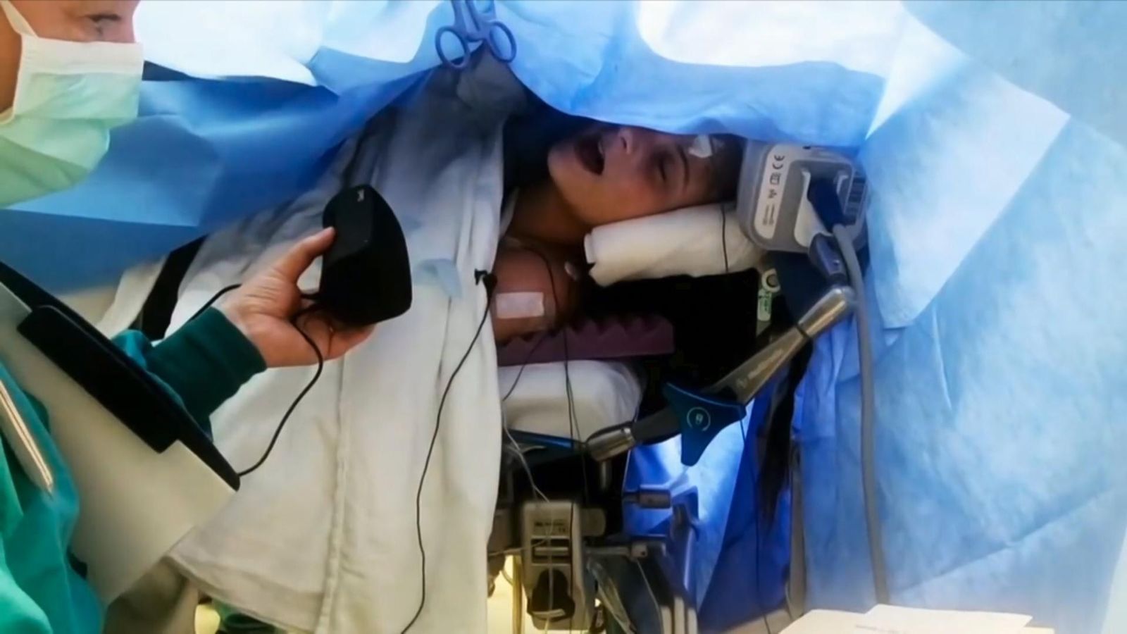 Girl sings during brain surgery Science, Climate & Tech News Sky News(02)