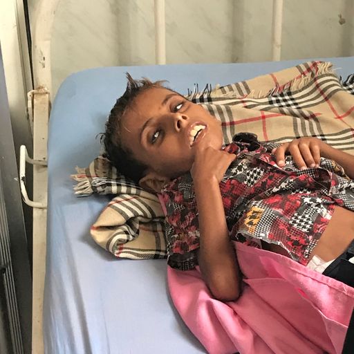 10-year-old boy who weighed just 10kg dies with country on brink of famine