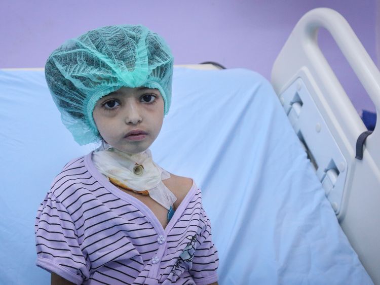 A girl at Al Thawra hospital, where Adam is being treated. Pic: Unicef