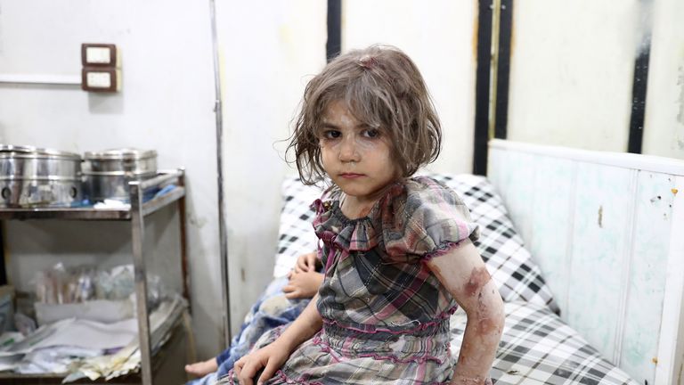 TOPSHOT - An injured Syrian child poses as she awaits treatment at a makeshift hospital following a reported air stike on the rebel-held town of Douma, east of the capital Damascus, on August 23, 2016. / AFP / Abd Doumany (Photo credit should read ABD DOUMANY/AFP/Getty Images)
