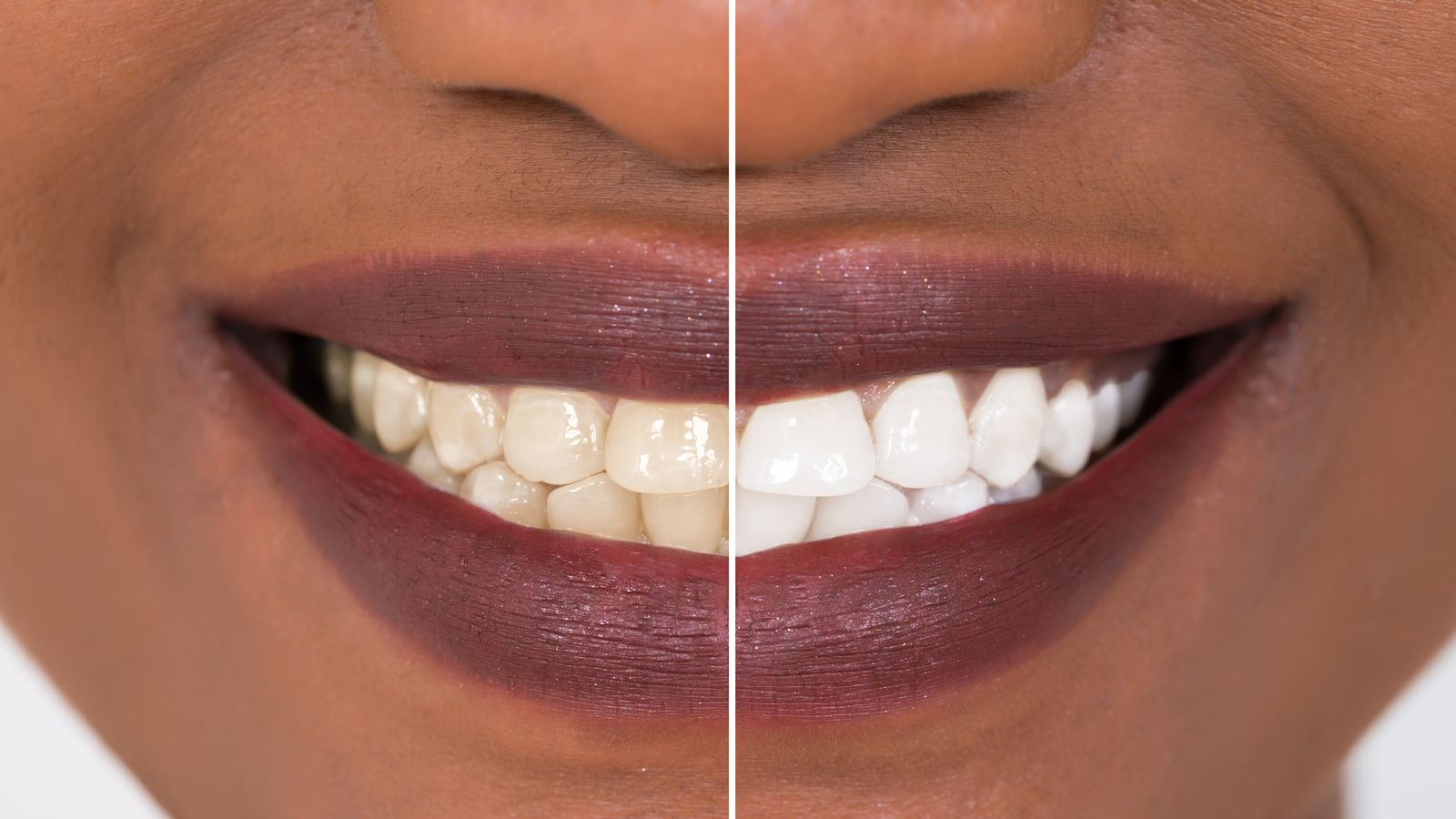 Consumers 'gambling with their teeth' by using whitening ...