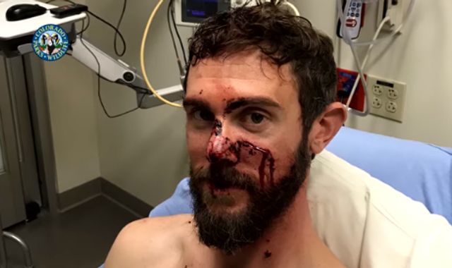 'One of my worst fears', says man who choked mountain lion 'One of my worst fears', says man who choked mountain lion