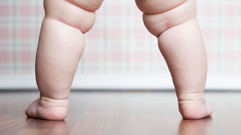 Children in the UK are more likely to be obese than in other countries