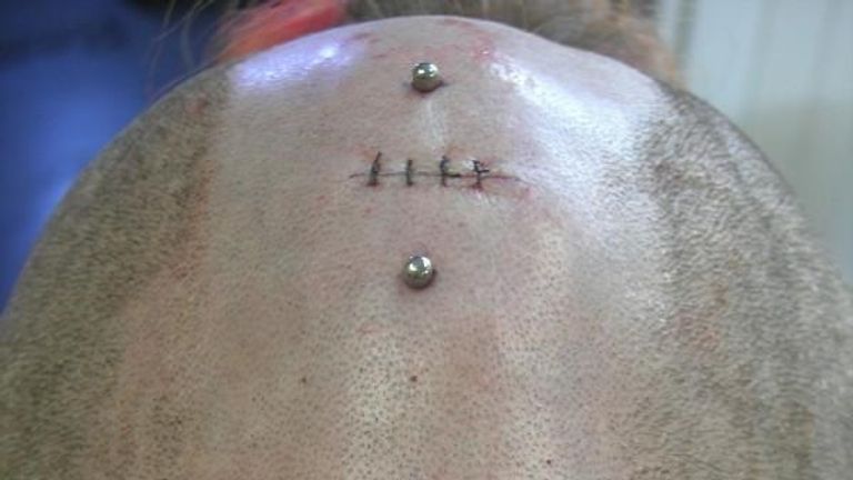 A body modification done at Dr Evil&#39;s. Pic: Myspace