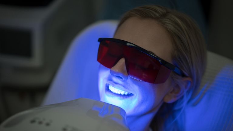 Many consumers have sought at-home alternatives to professional whitening treatments. File pic