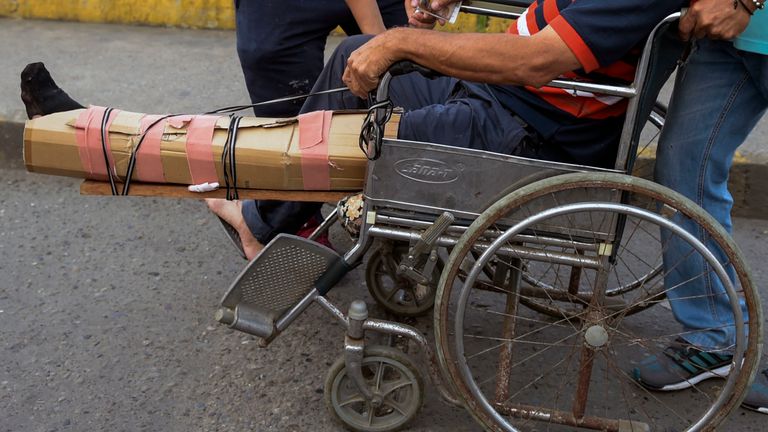 A man with an improvised splint is wheeled across the Simon Bolivar International Bridge on the border between the Colombian city of Cucuta and the Venezuelan Tachira