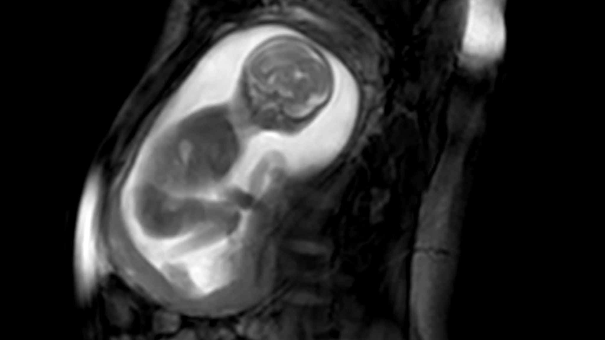 Groundbreaking images of unborn baby in womb Science & Tech News