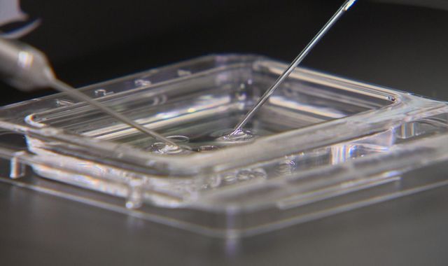 Calls for IVF treatment to face further regulation Calls for IVF treatment to face further regulation