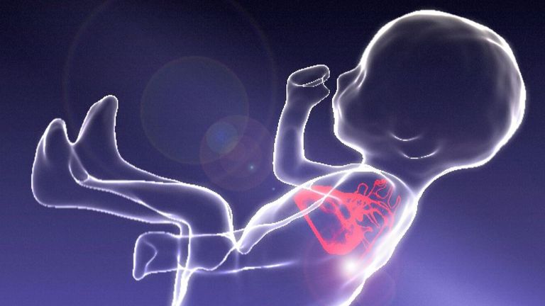 3D imaging of a fetus's heart