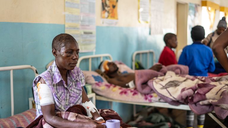 Praise Chipore, 31, a cyclone survivor, sits on a hospital bed at Chimanimani Rural district hospital, Manicaland Province, eastern Zimbabwe, on March 18 2019, after the area was hit by the cyclone Idai. - A cyclone that ripped across Mozambique and Zimbabwe has killed at least 162 people with scores more missing. Cyclone Idai tore into the centre of Mozambique on the night of March 14 before barreling on to neighbouring Zimbabwe, bringing flash floods and ferocious winds, and washing away roads