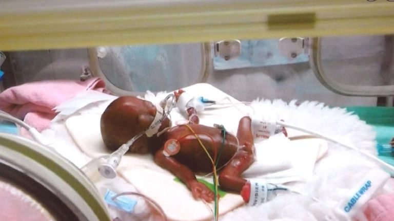A baby who weighed just 258 grams when he was born at 24 weeks is finally set to leave the hospital with his parents.