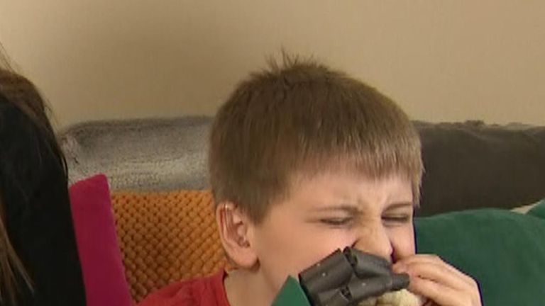 Freddie Payne is the world&#39;s youngest recipient of a bionic arm. 