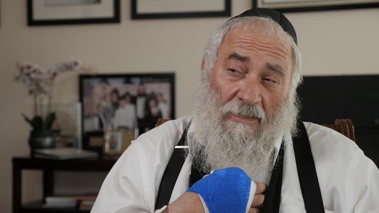 Rabbi Yisroel Goldstein lost a finger during the shooting at the Chabad of Poway