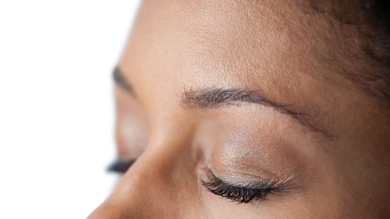 The delicate eyelid region is prone to skin cancer