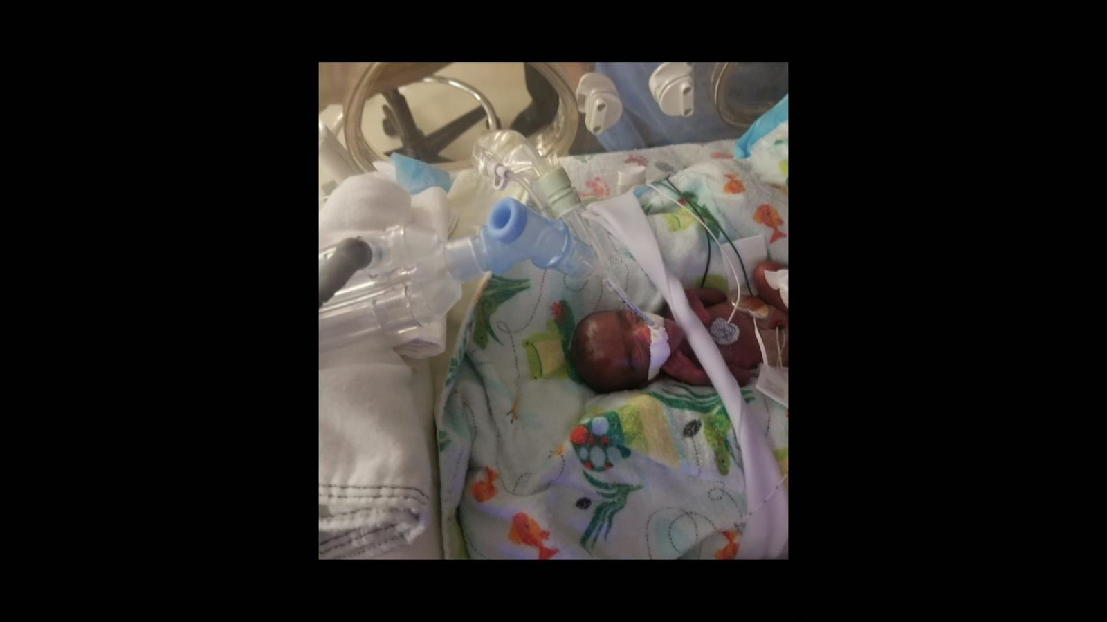 World's tiniest baby only had hour to live, but she is now a healthy infant US News Sky News