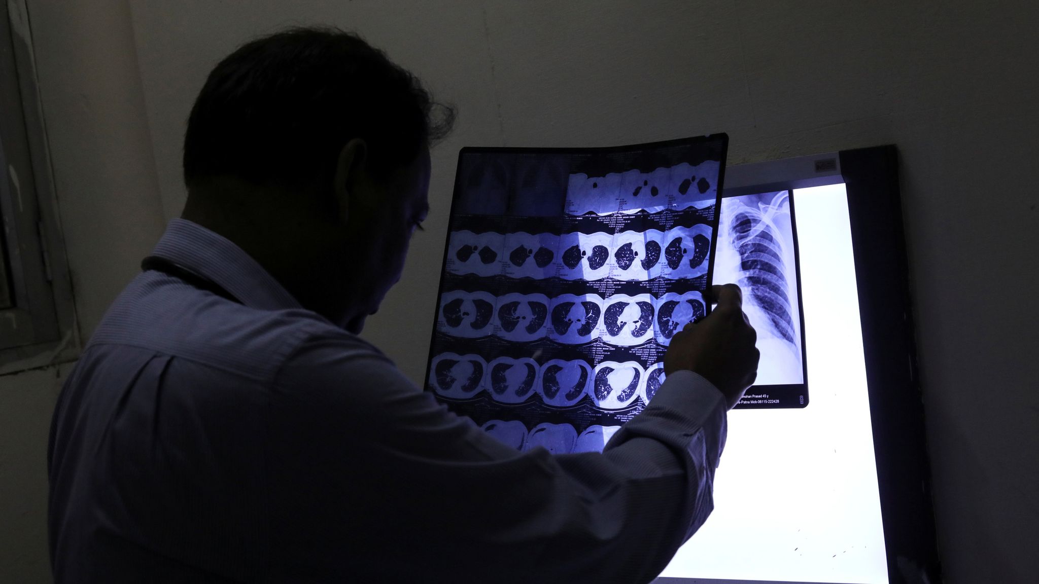 Most GPs illequipped to diagnose one of the deadliest cancers UK