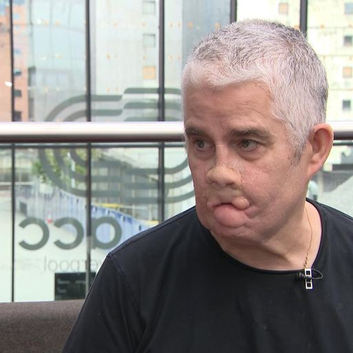 Having sepsis 'was like dying and coming back to life'