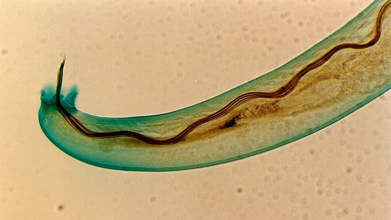 The angiostrongylus cantonensis worm. Pic: Punlop Anusonpornperm