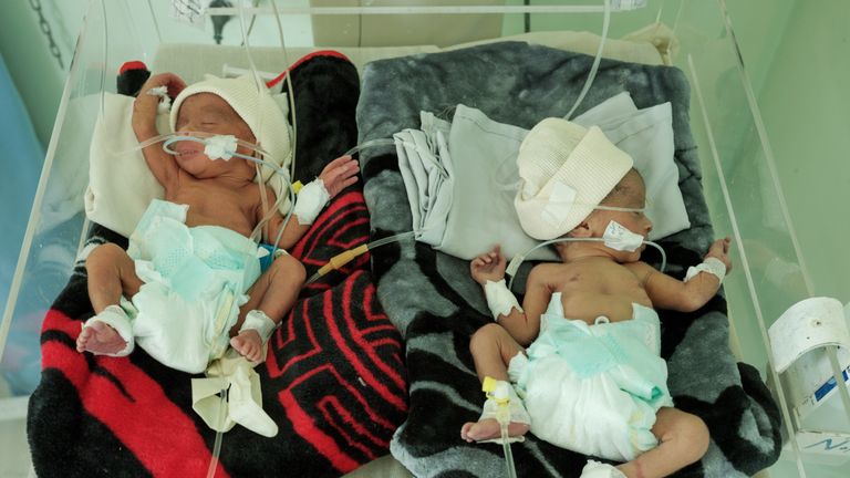 Two premature twins are closely monitored at the maternity department of one of MSF&#39;s hospitals. Pic: Matteo Bastianelli/MSF
