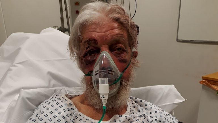 The 80-year-old victim was knocked unconscious after being shoved by a motorist