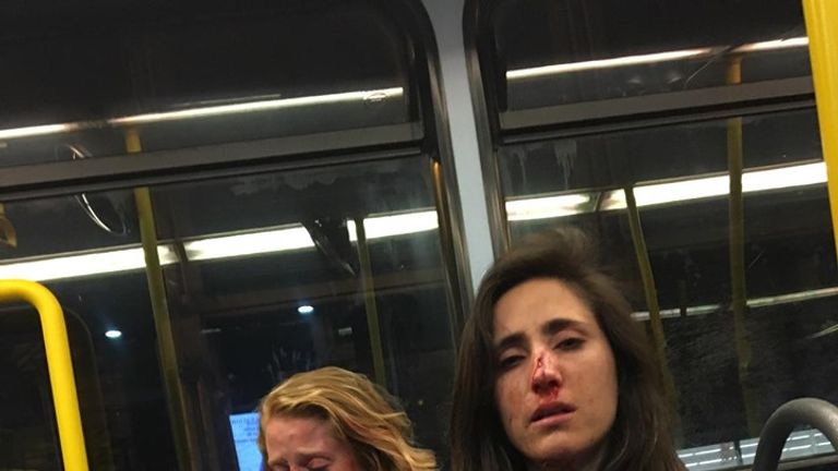 Melania Geymonat and her girlfriend Chris were left bloodied after the attack. Pic: Melania Geymonat