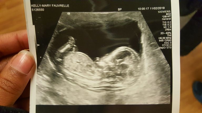 Kelly Mary Fauvrelle reportedly uploaded an ultrasound image to her Facebook page in February