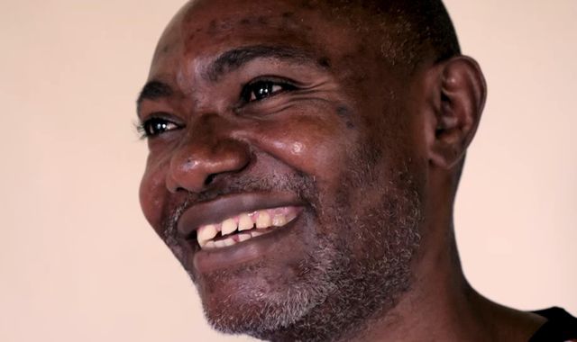 This doctor survived Ebola. Now, he treats other sufferers