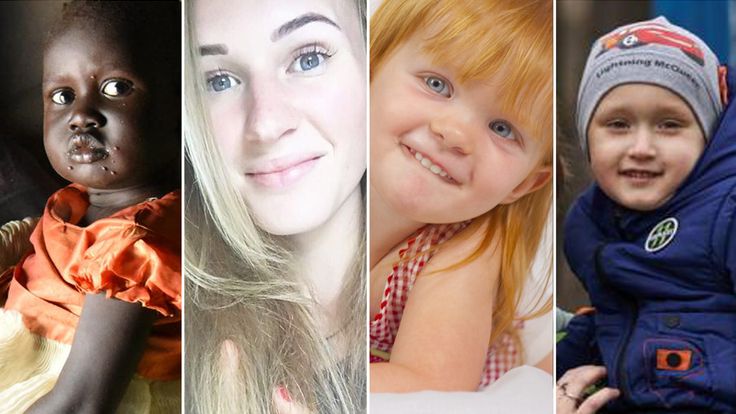 Four victims of not vaccinating