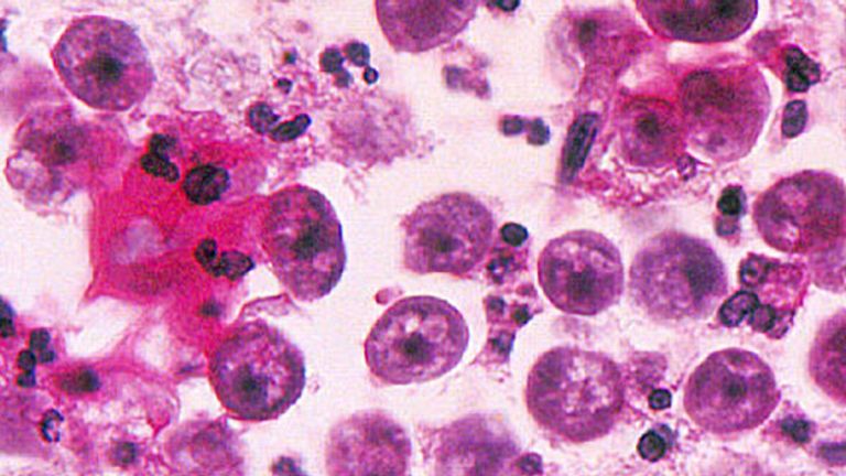The brain-eating amoeba is known to have infected just 145 people in the US between 1962 and 2018. Pic: CDC