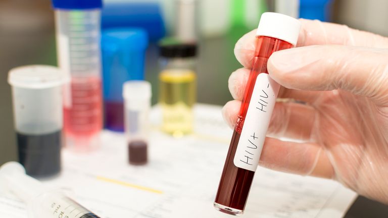 HIV blood in test tube