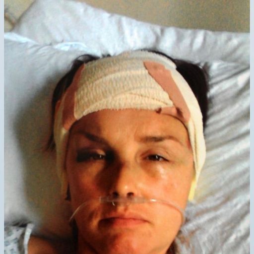 Health staff 'missing opportunities' to spot signs of domestic abuse