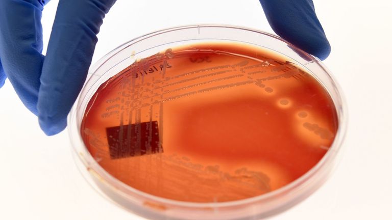 Superbug Staphylcocus epidermidis on an agar plate