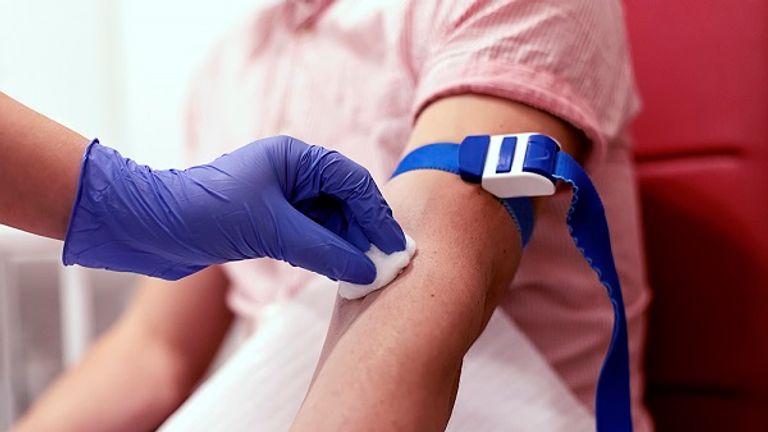 Scientists hope a blood test will become available to GPs within a few years