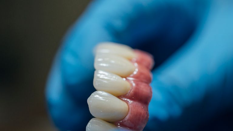 Pensioner Spent Eight Days With His False Teeth Stuck In His Throat After Surgery Uk News