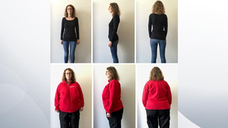 Scientists think getting patients to wear fat suits could reveal prejudices of doctors. Pic: British Medical Journal