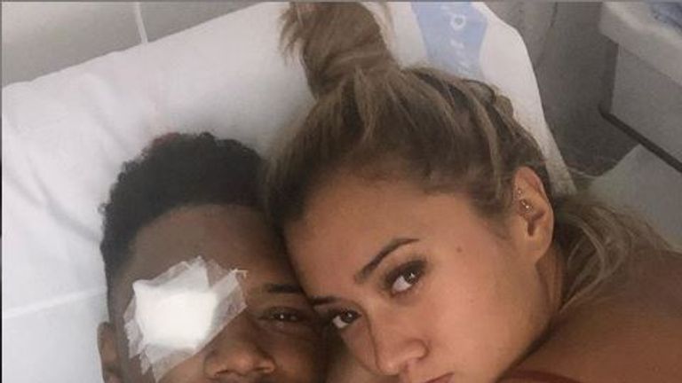 Campbell posted a photo of his injured eye, alongside girlfriend Kaz Crossley. Pic: Theo Campbell/Instagram