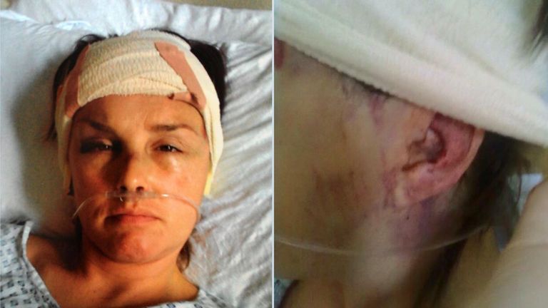 Rachel Williams during her recovery. Pic: Rachel Williams