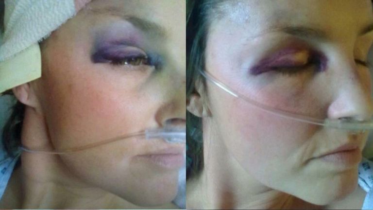 Rachel Williams during her recovery. Pic: Rachel Williams