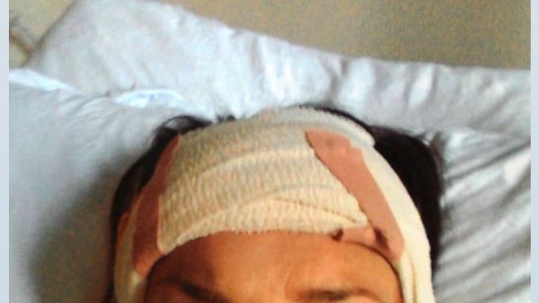 Rachel Williams during her recovery. Pic: Rachel Williams