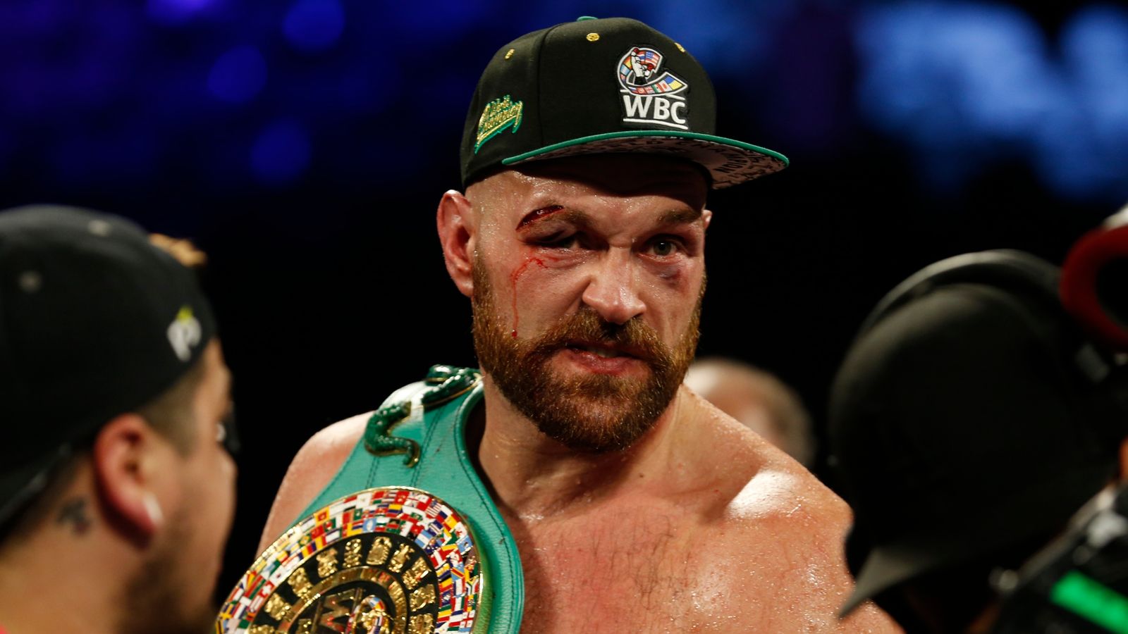 Tyson Fury overcomes bloodied eye to beat Otto Wallin on points | UK