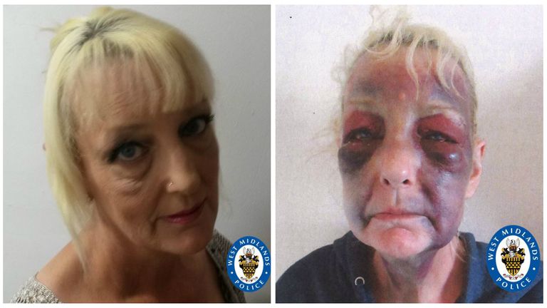 Lynn Hart suffered horrific injuries at the hands of her partner. Pic: West Midlands Police